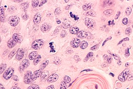 Microscopic image of cells damaged by a high dose of radiation. (Source: © David A Litman / stock.adobe.com)