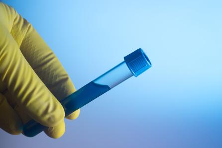 Radioactive isotopes are often used as tracers. They can help to detect leaks or monitor the uptake of pharmaceuticals. Materials contaminated with radionuclides become radioactive waste. (Source: © Maxim / stock.adobe.com)